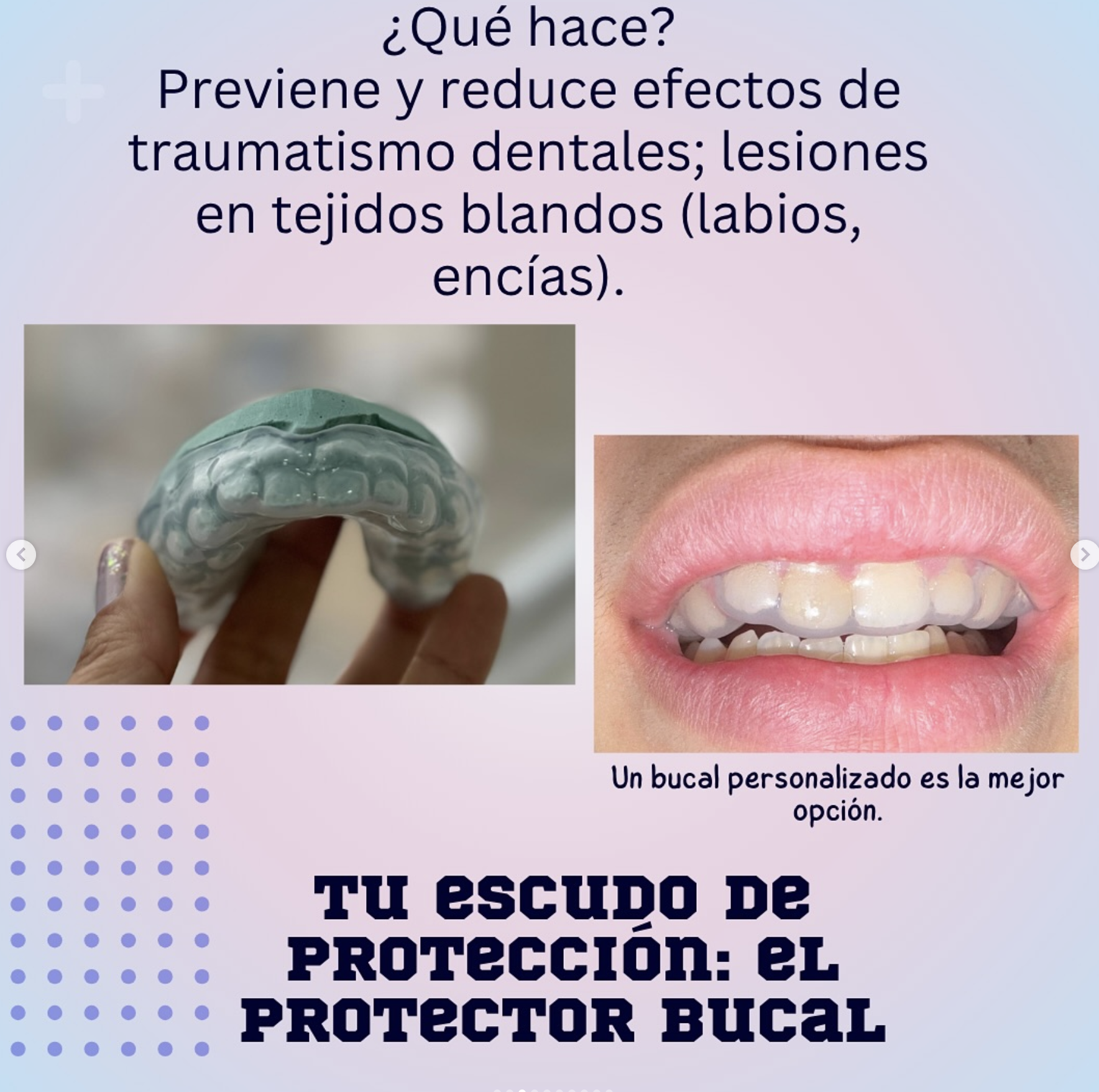 Protector bucal personalizado