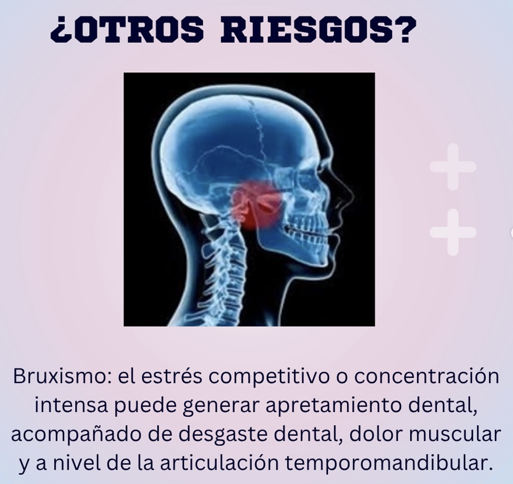 Bruxismo: estrés competitivo y desgaste dental